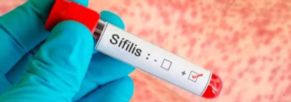 casos de sifilis